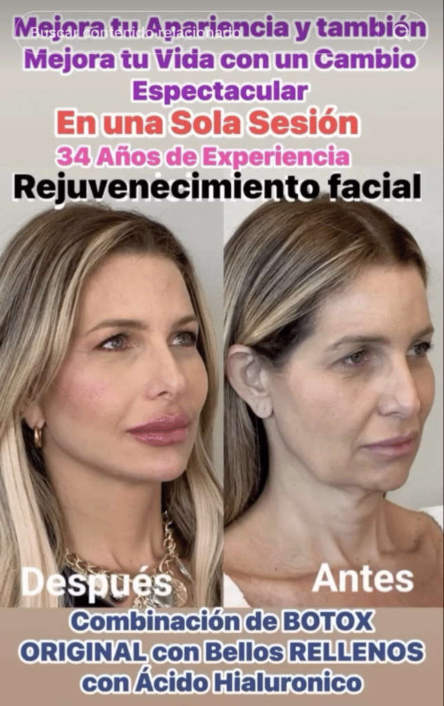 Belleza en oferta: “Las cirugías no se deben de vender como electrodomésticos en redes sociales”
